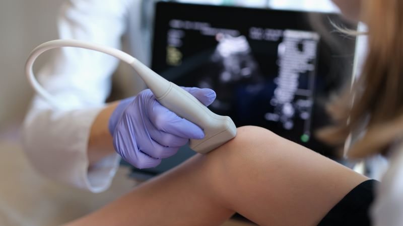 Musculoskeletal Ultrasound